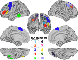 Region Figure