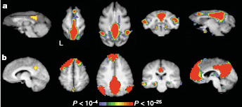 Fig. 4 of Vincent et al., 2007